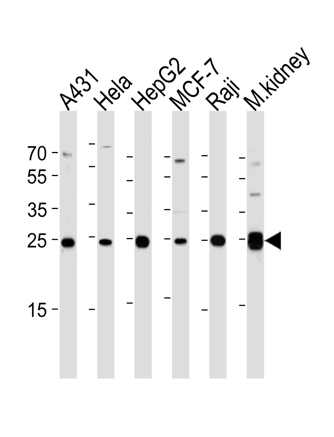 Rabbit Polyclonal Antibody to AK4
