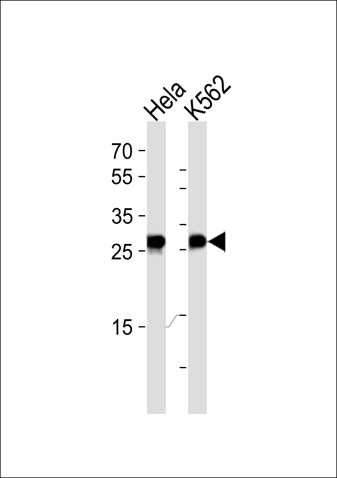 Rabbit Polyclonal Antibody to EEF1B2