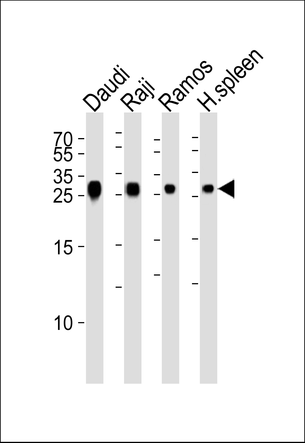 Rabbit Polyclonal Antibody to HLA-DRB1