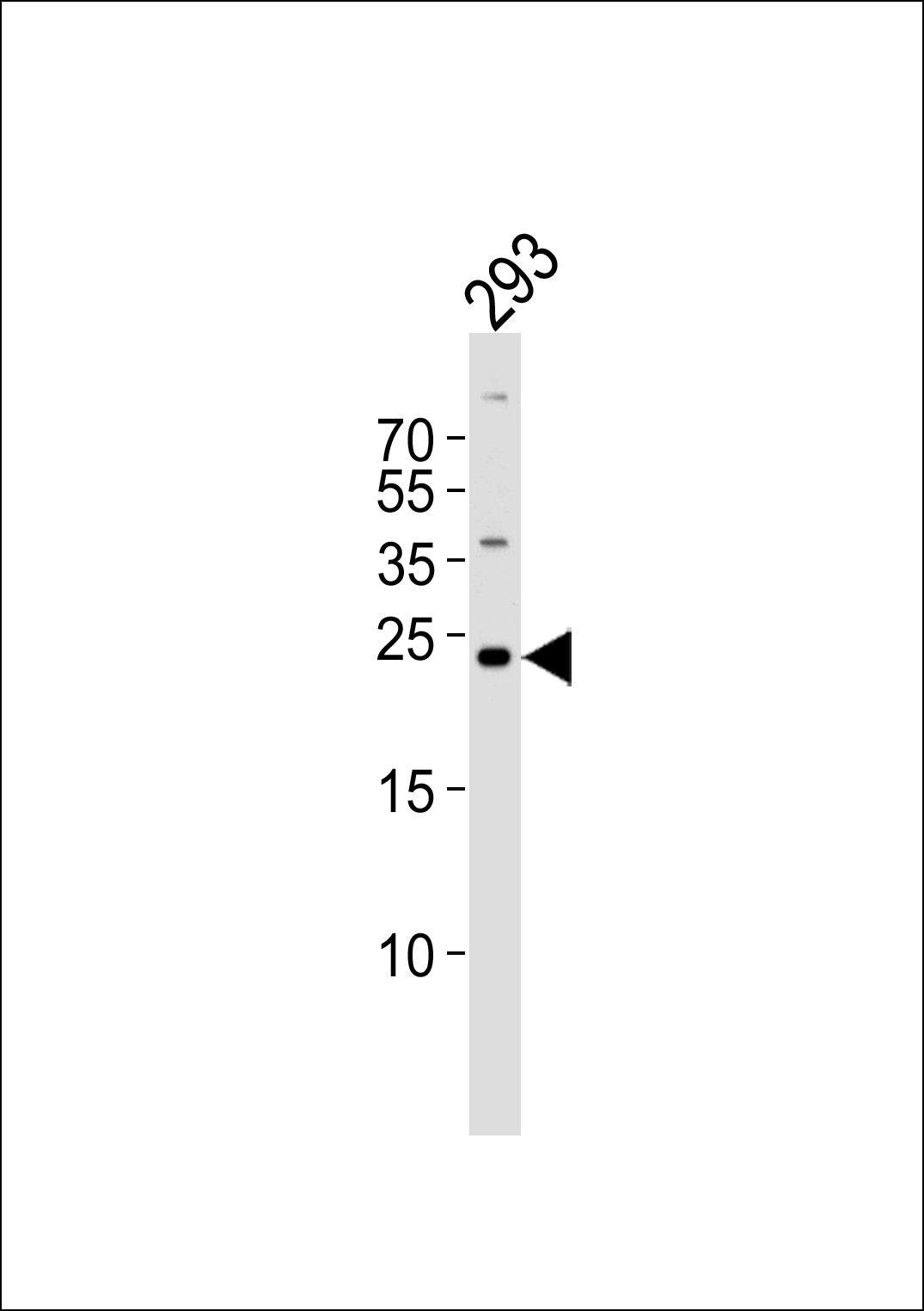Rabbit Polyclonal Antibody to GADD45GIP1 (N-term)