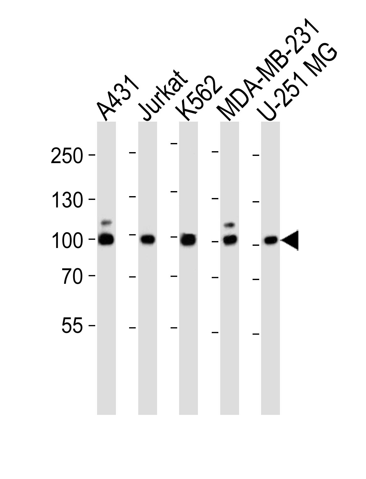 Rabbit Polyclonal Antibody to ZNF175 (N-term)