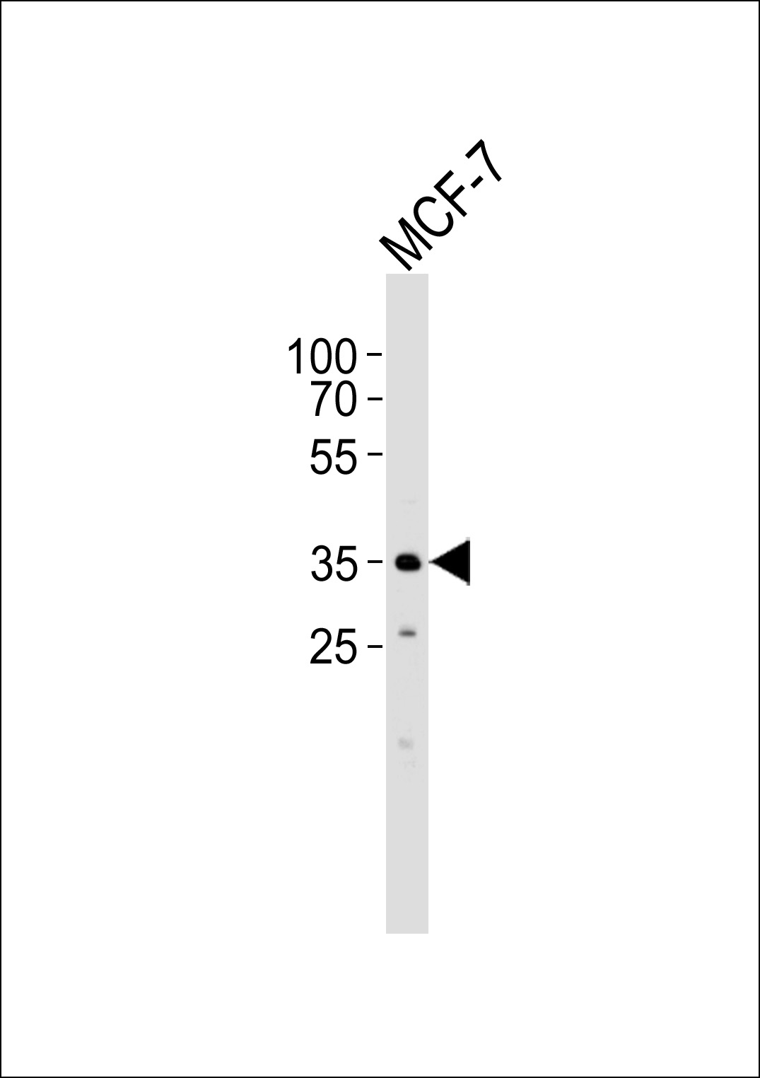 Rabbit Polyclonal Antibody to FBXL17 Isoform 2