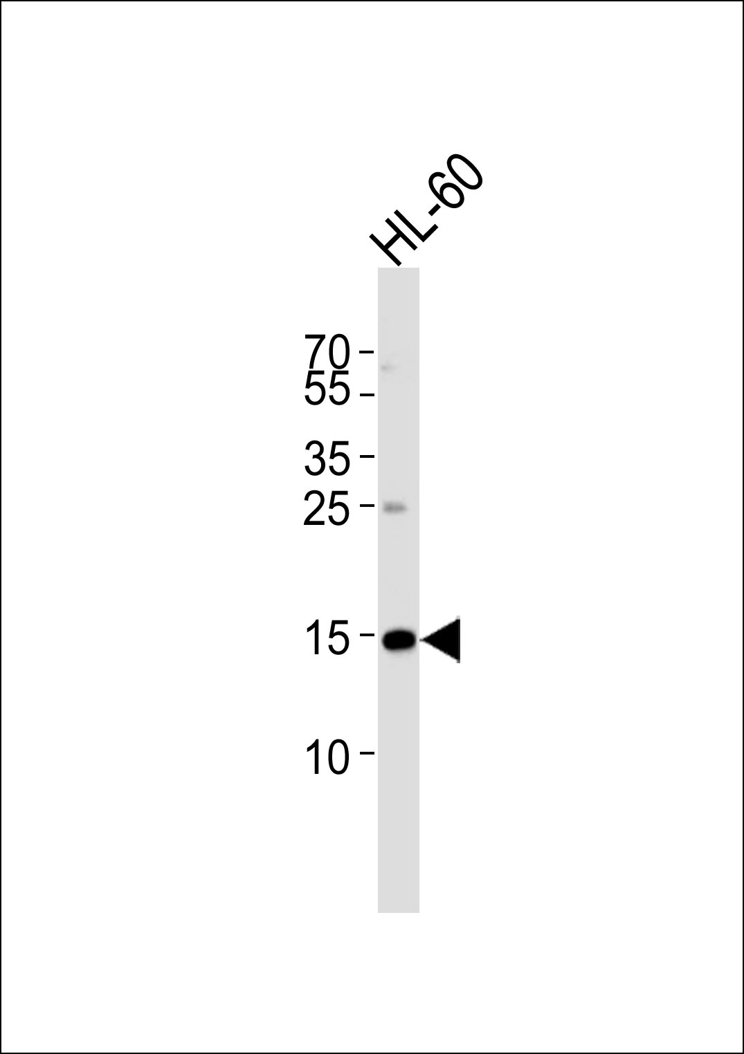 Rabbit Polyclonal Antibody to UBE2L6 (N-term)