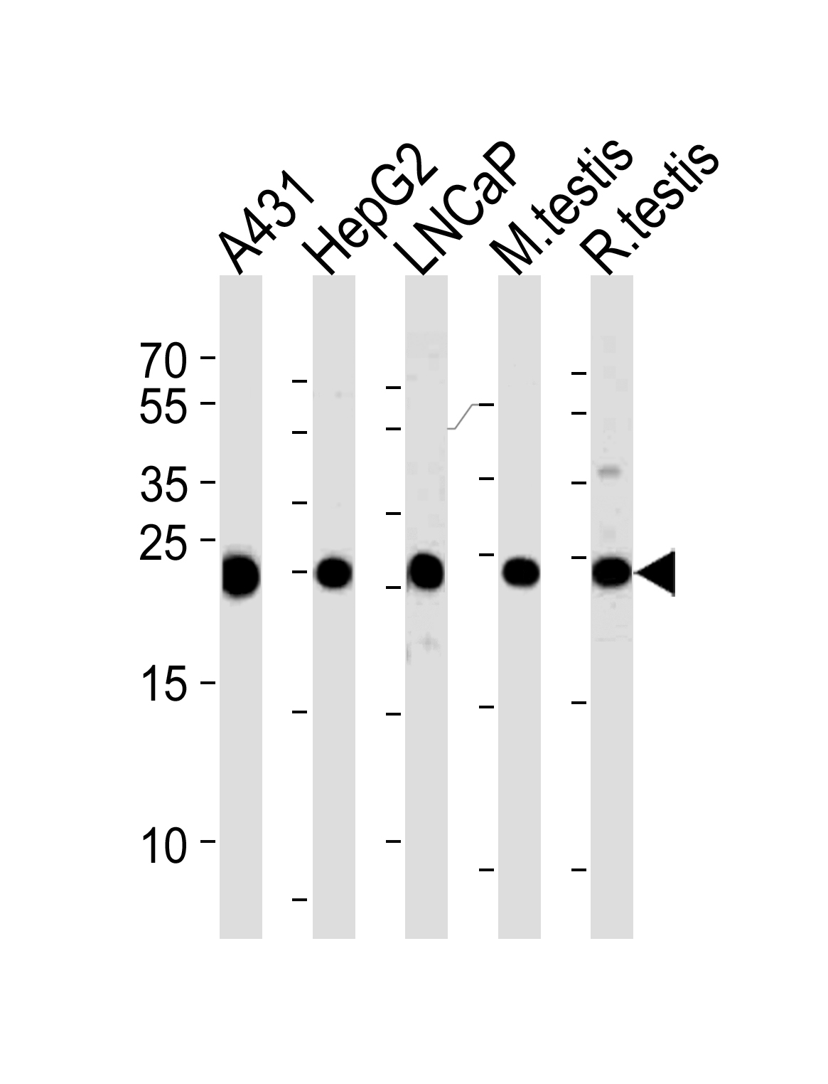 Rabbit Polyclonal Antibody to TPI1