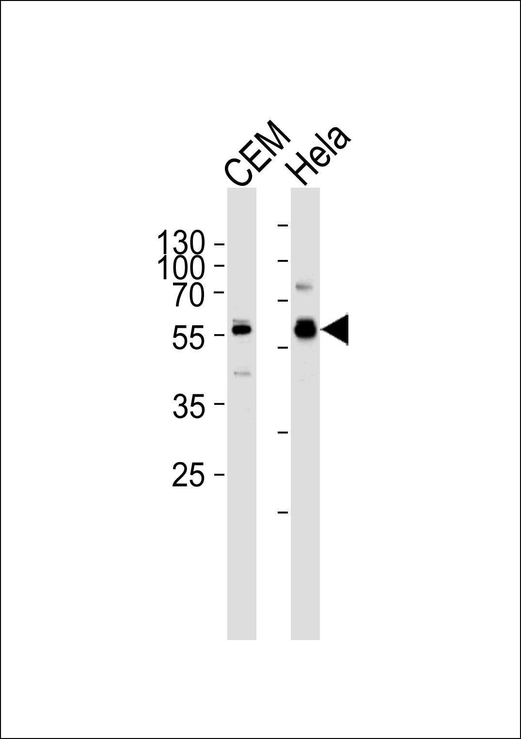 Rabbit Polyclonal Antibody to DYRK2 (N-term)