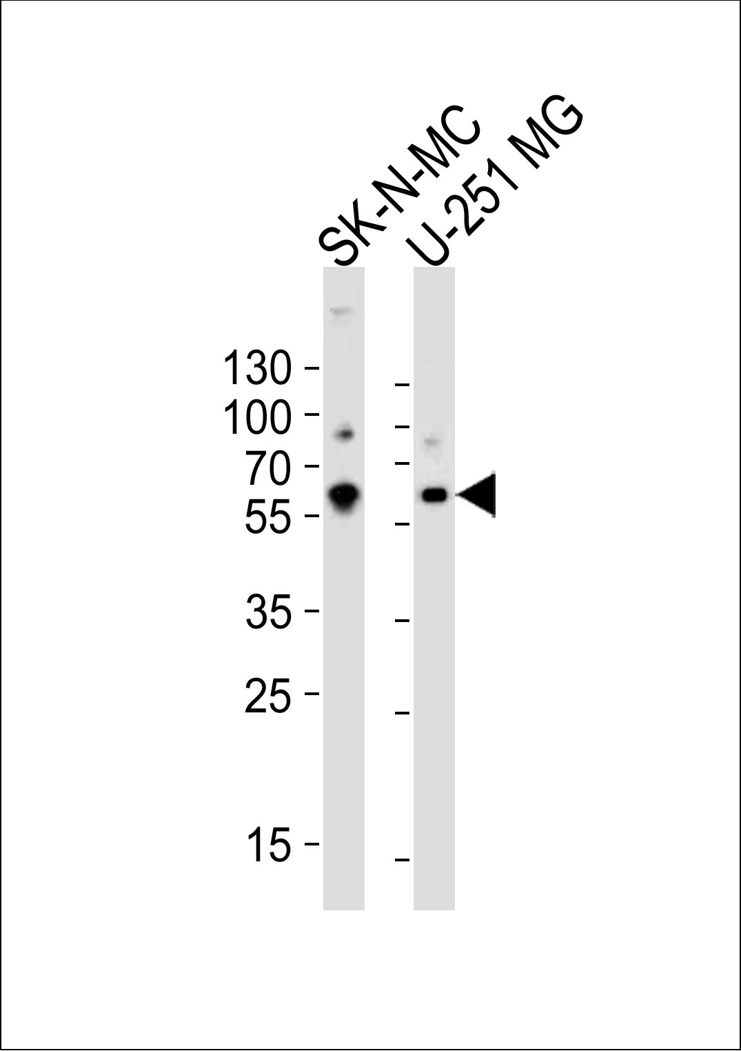 Rabbit Polyclonal Antibody to SEPT4 (N-term)
