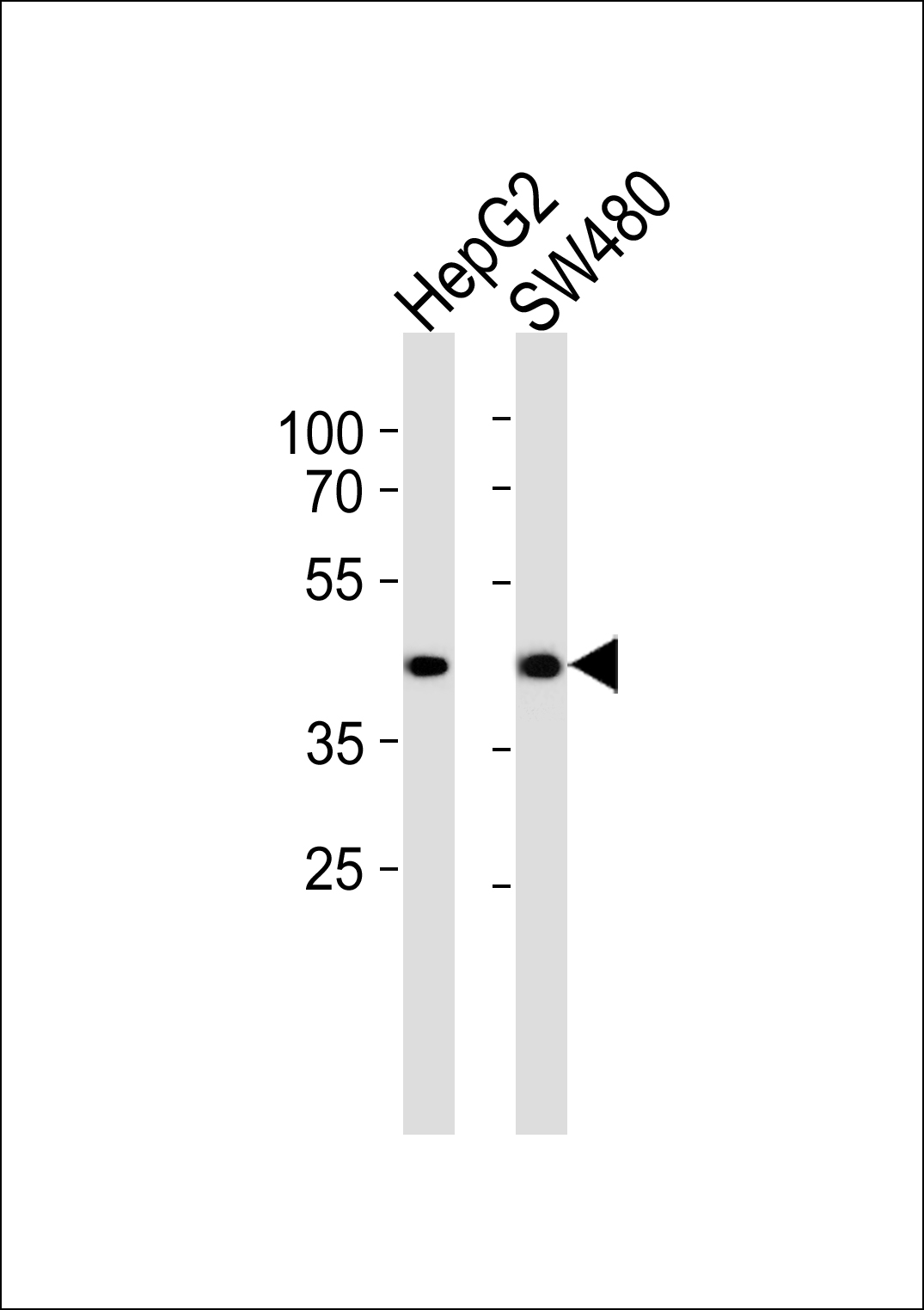 Rabbit Polyclonal Antibody to ADH7