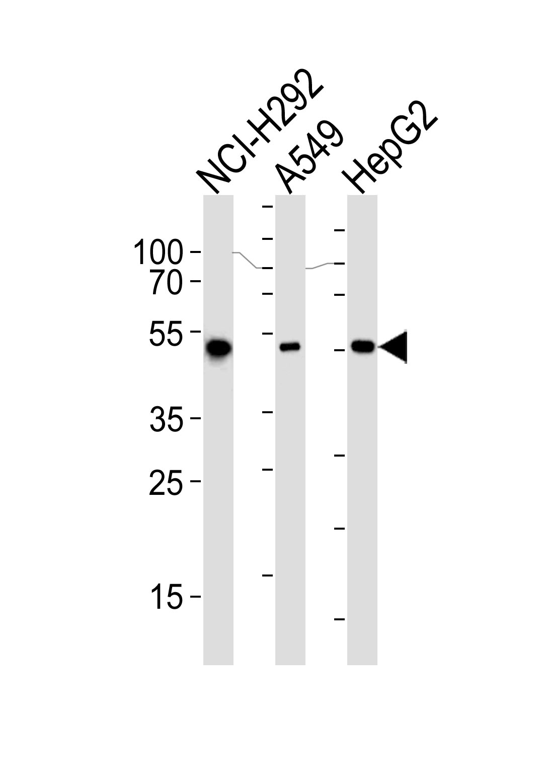 Mouse Monoclonal Antibody to ALDH2