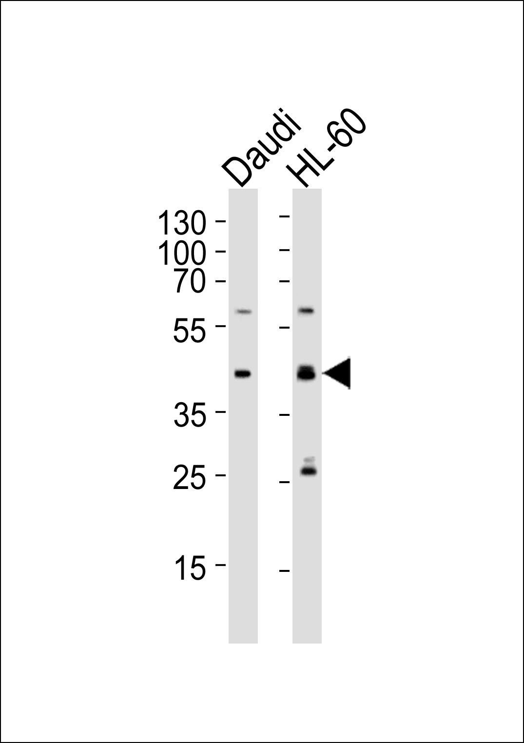 Rabbit Polyclonal Antibody to C109B
