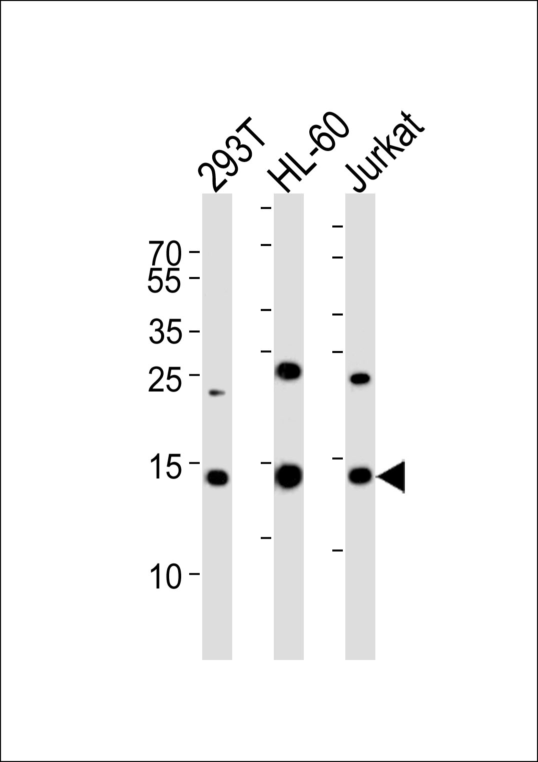 Rabbit Polyclonal Antibody to SUMO2