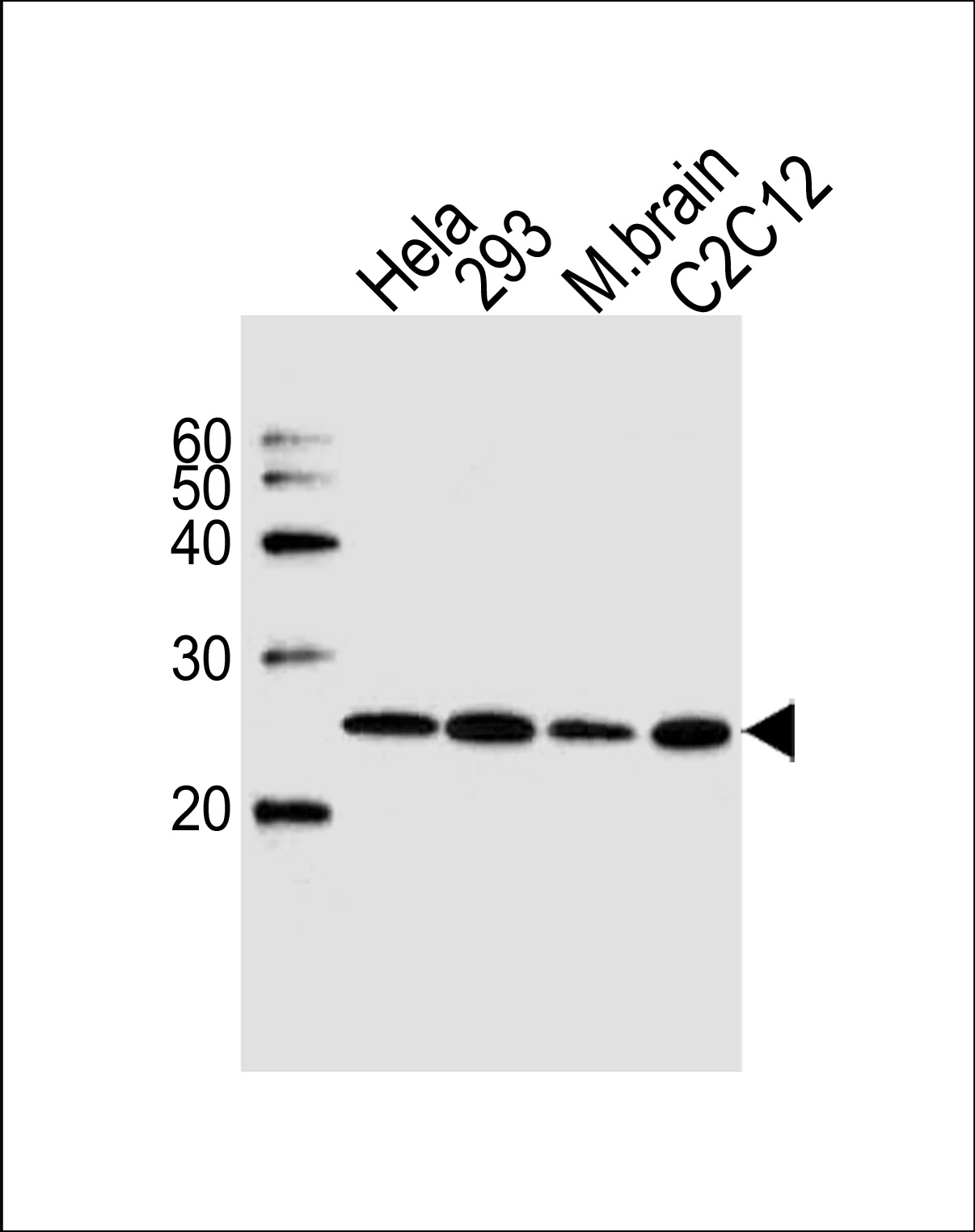 Rabbit Polyclonal Antibody to UBE2K(N-term)