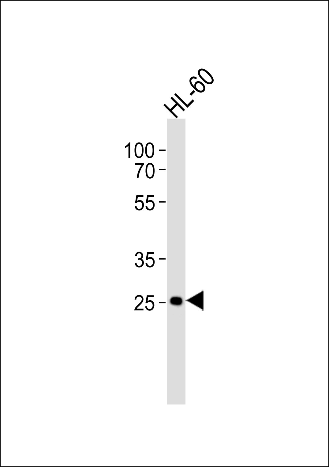 Rabbit Polyclonal Antibody to FCGR3B (N-term)