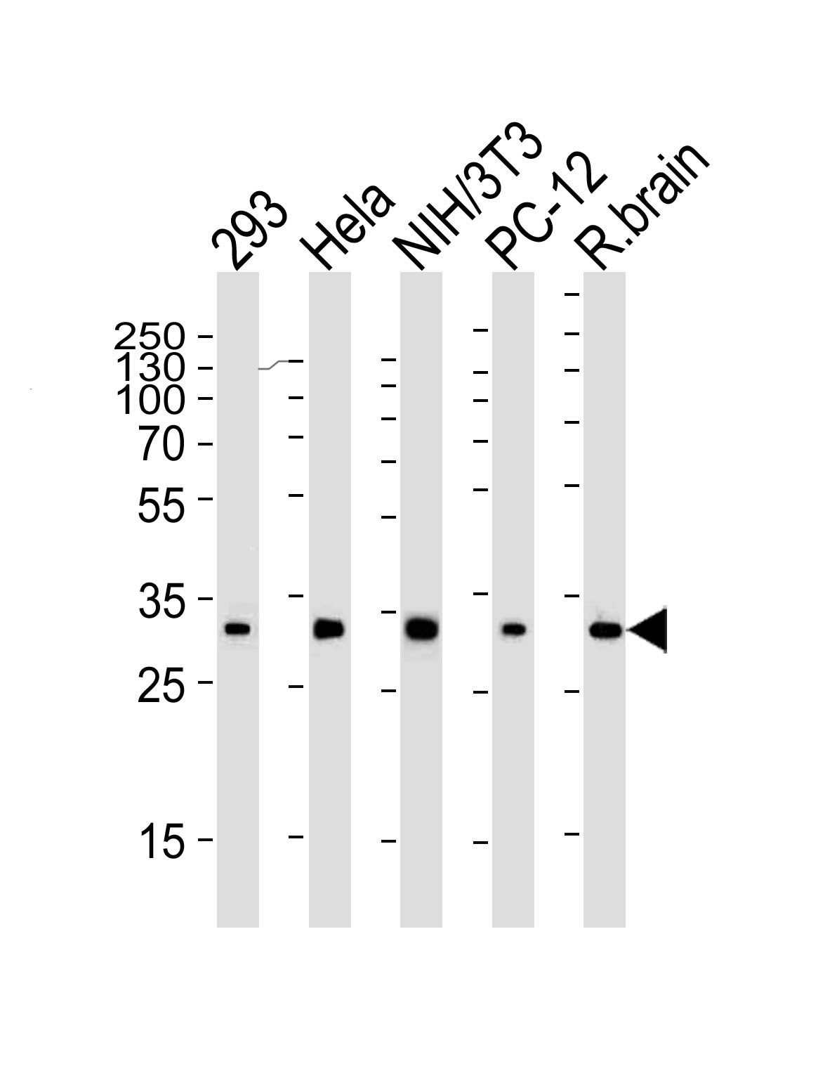 Mouse Monoclonal Antibody to RPS6 (N-term)