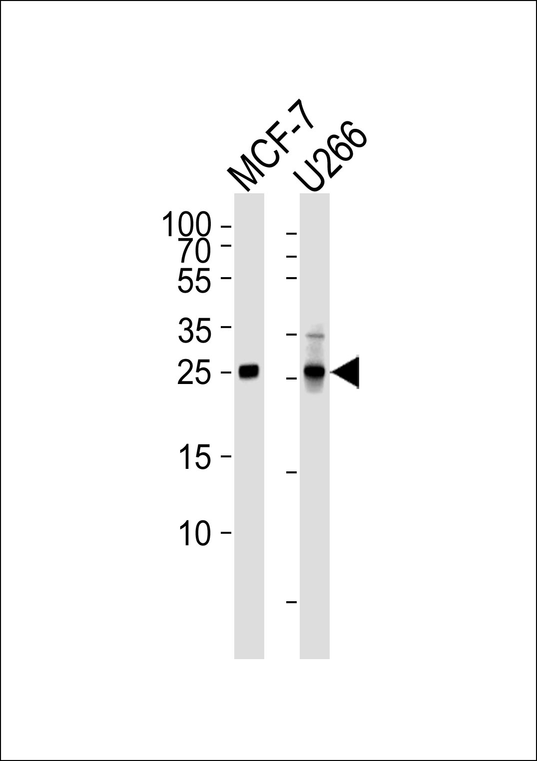 Mouse Monoclonal Antibody to CDKN1B