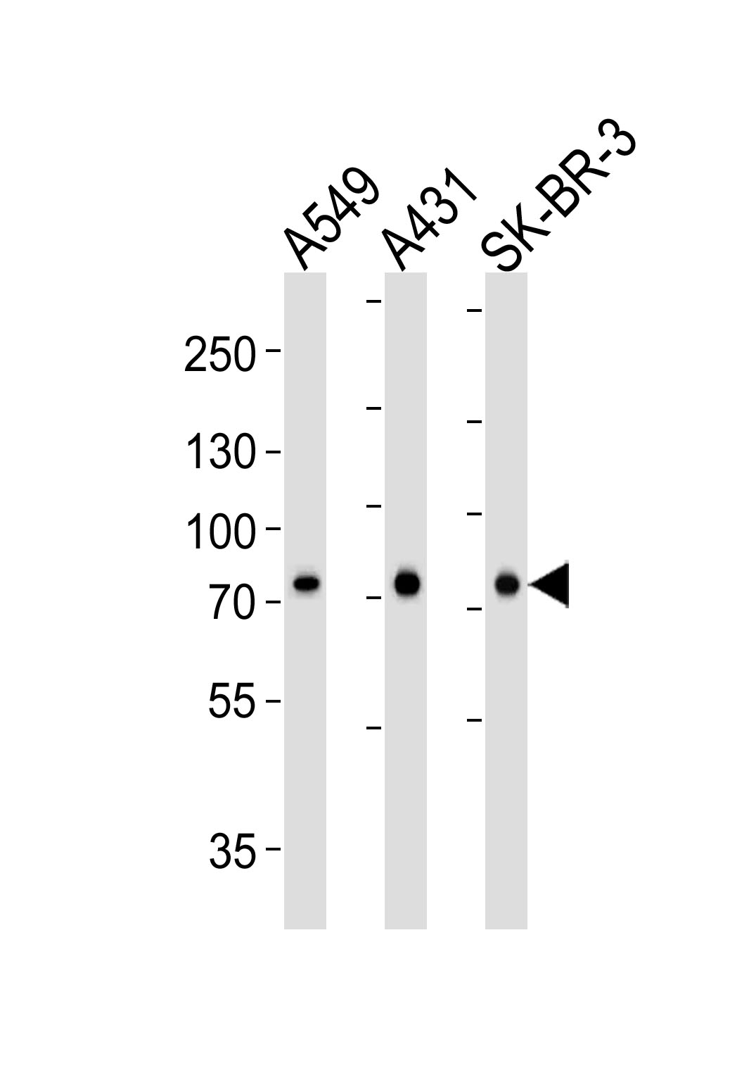 Mouse Monoclonal Antibody to CAPN2