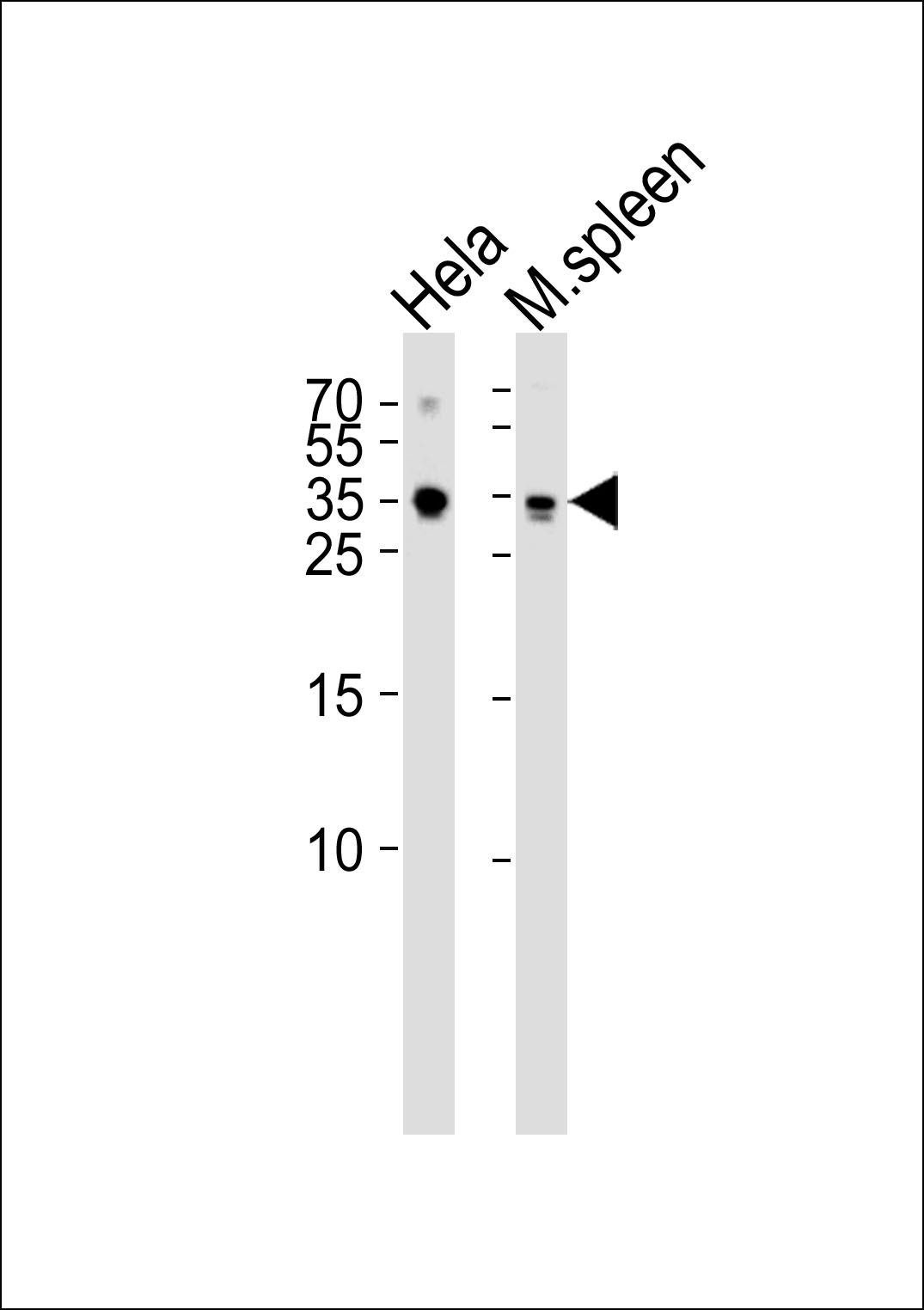 Rabbit Polyclonal Antibody to TCF21