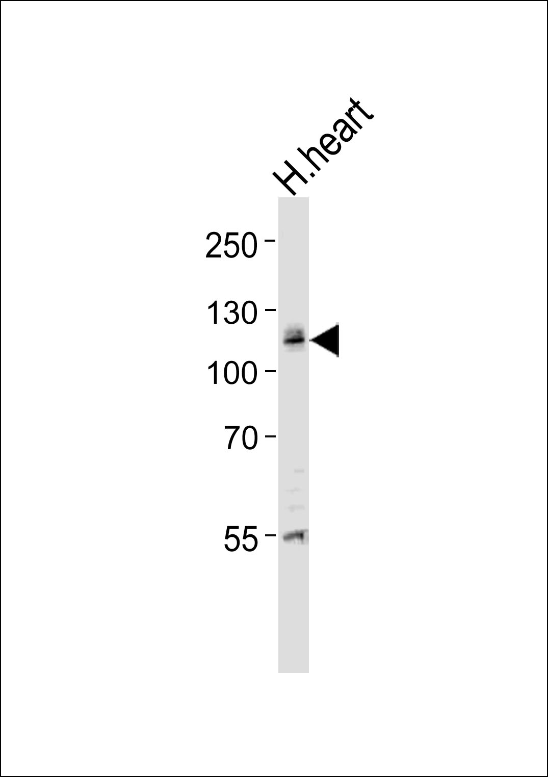 Rabbit Polyclonal Antibody to IDE