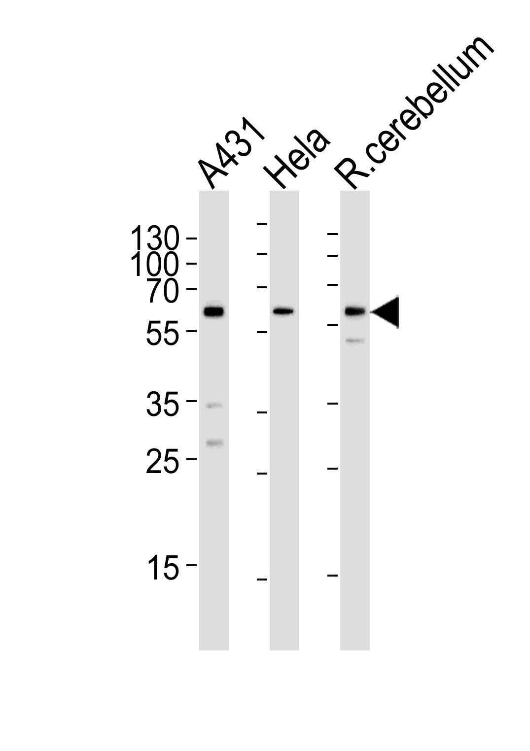 Rabbit Polyclonal Antibody to KISS1R