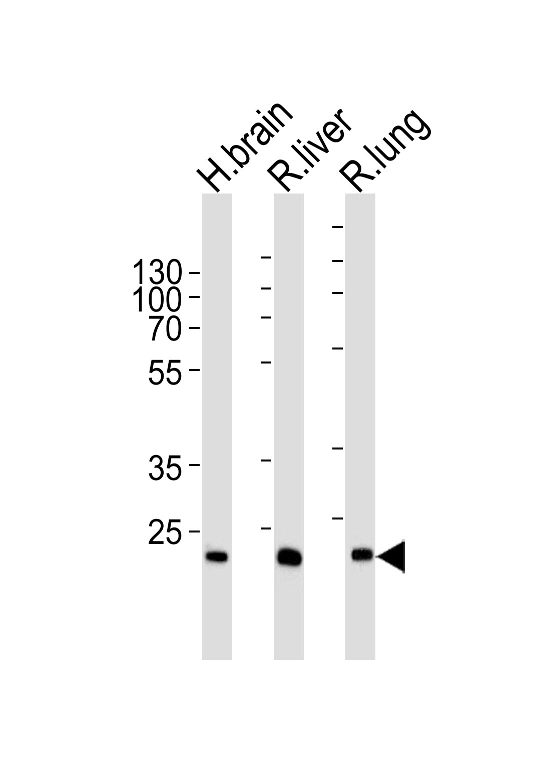 Rabbit Polyclonal Antibody to GSTT1 (N-term)