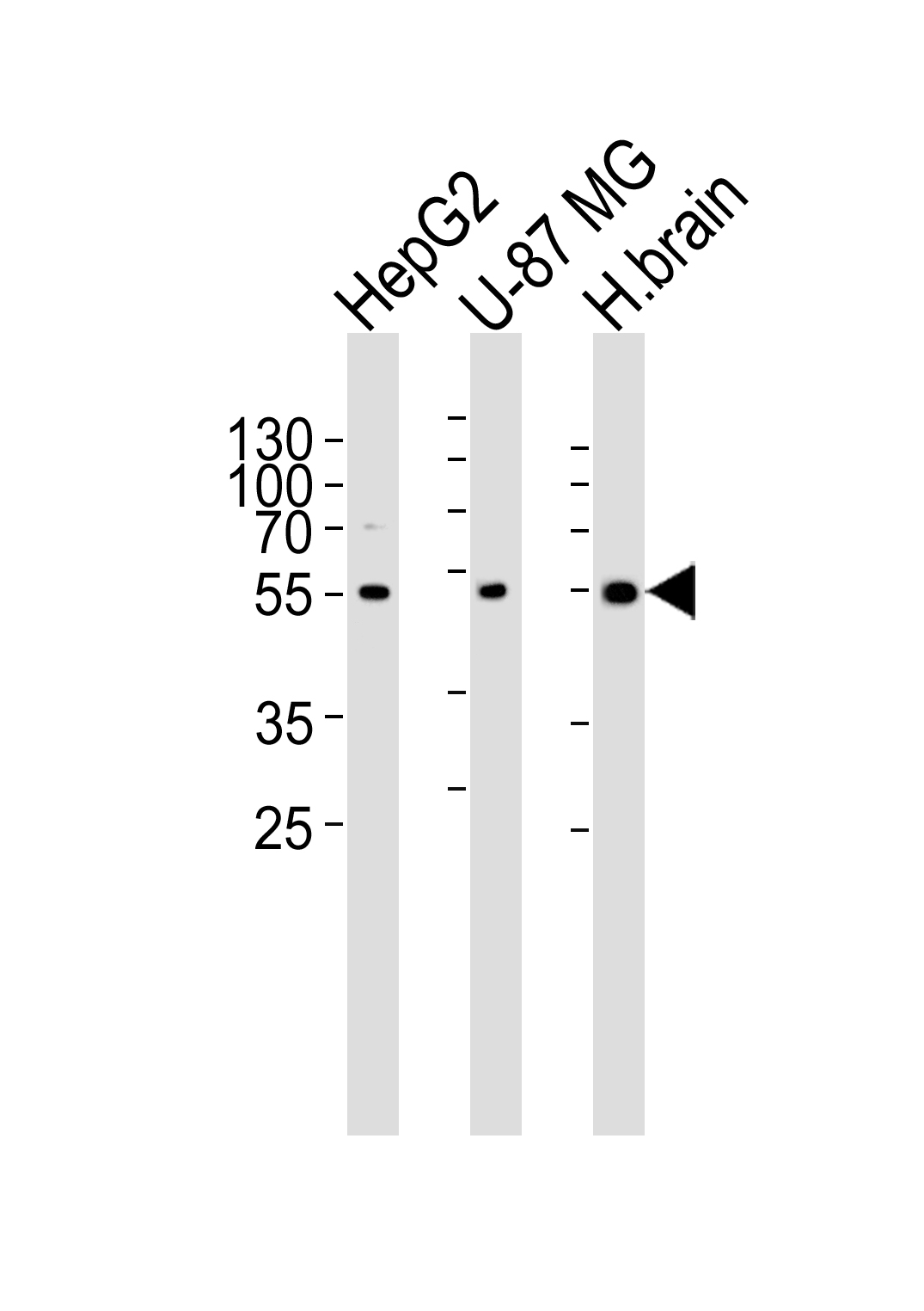 Rabbit Polyclonal Antibody to RGS20