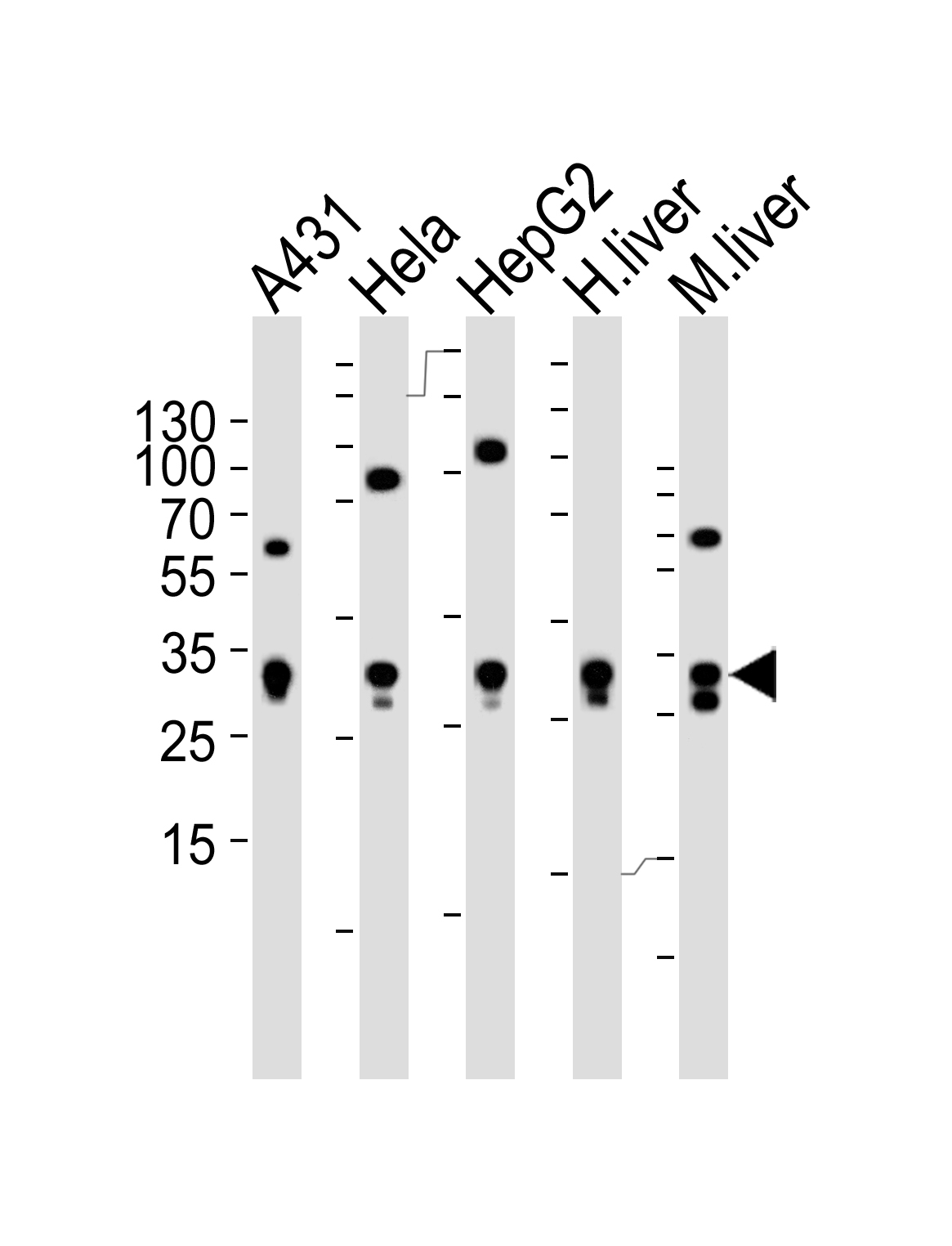 Rabbit Polyclonal Antibody to ETFA
