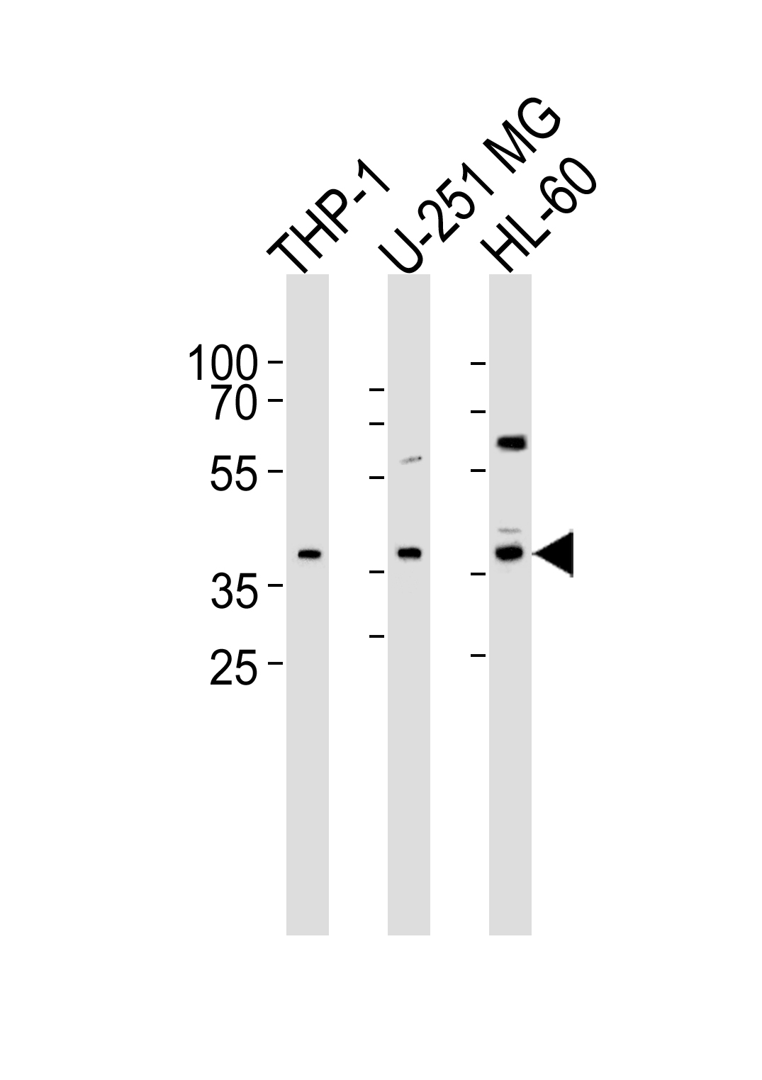 Rabbit Polyclonal Antibody to RAD9B