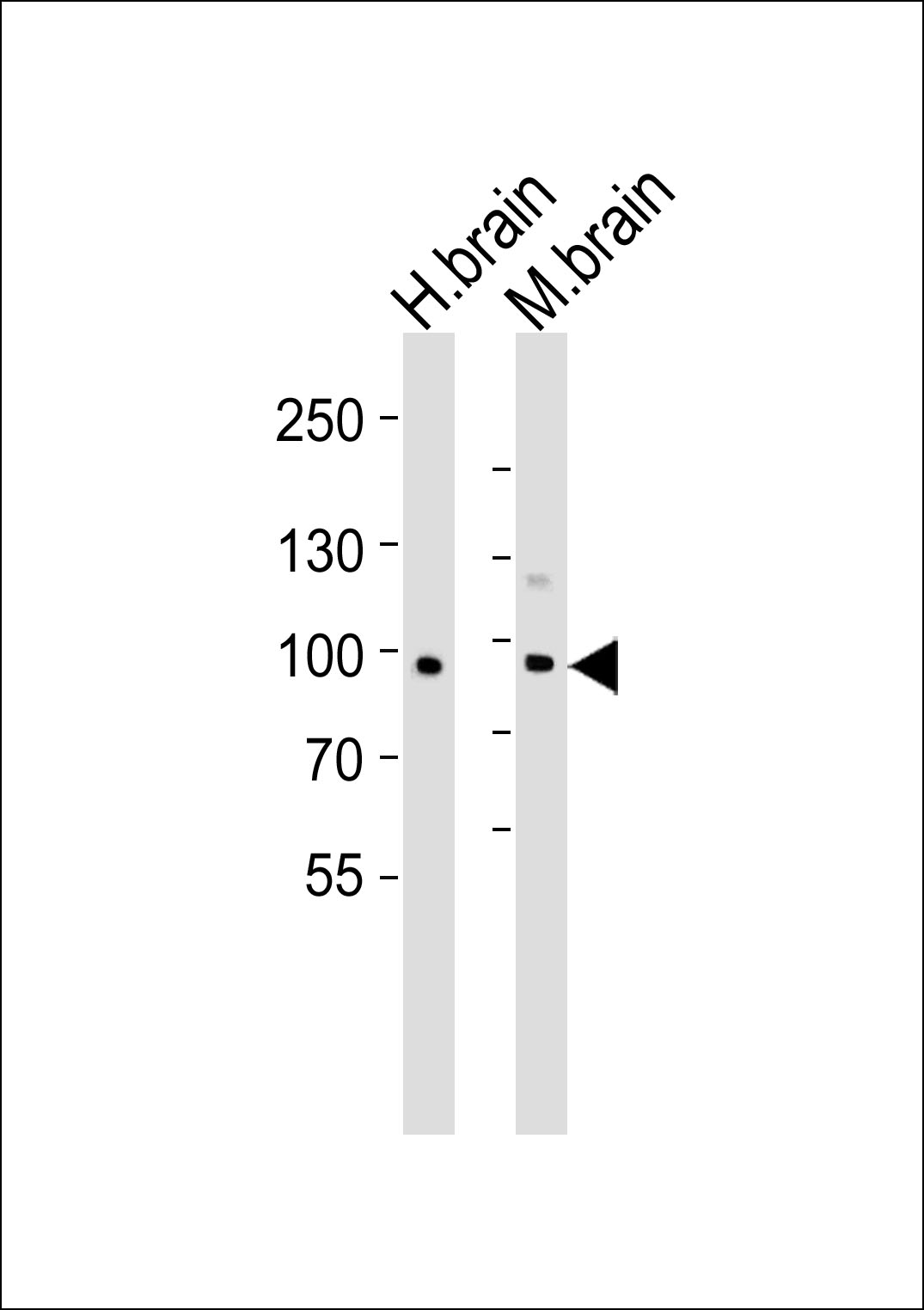 Rabbit Polyclonal Antibody to CDH20 (N-term)
