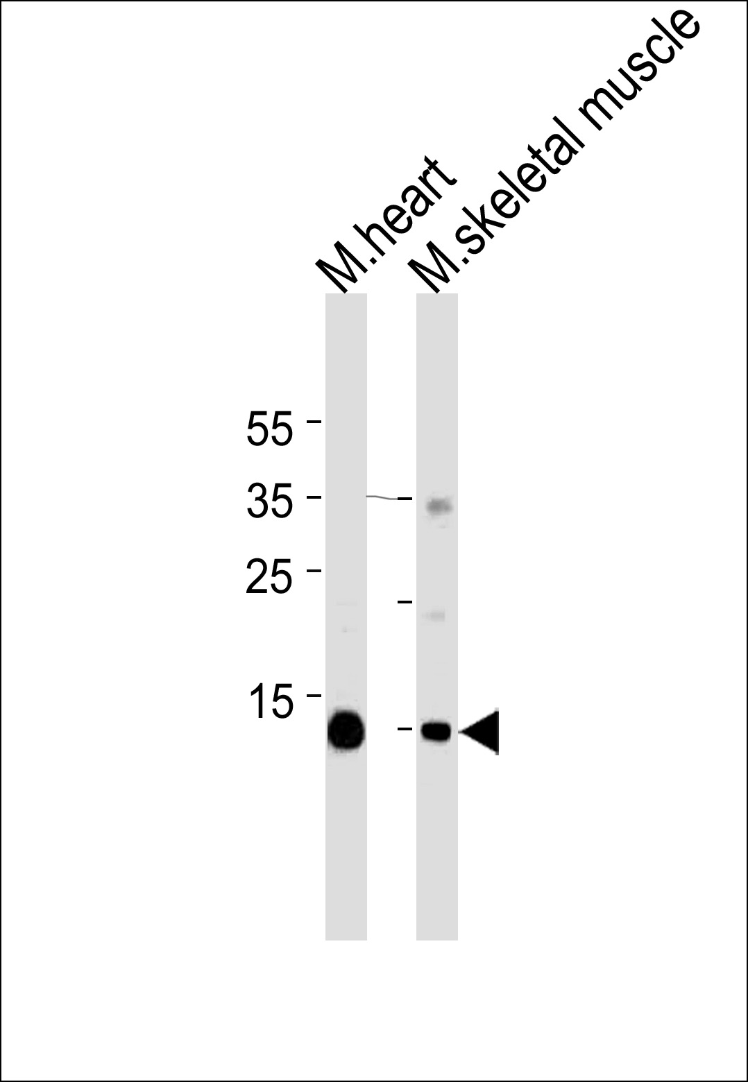 Mouse Monoclonal Antibody to Myoglobin