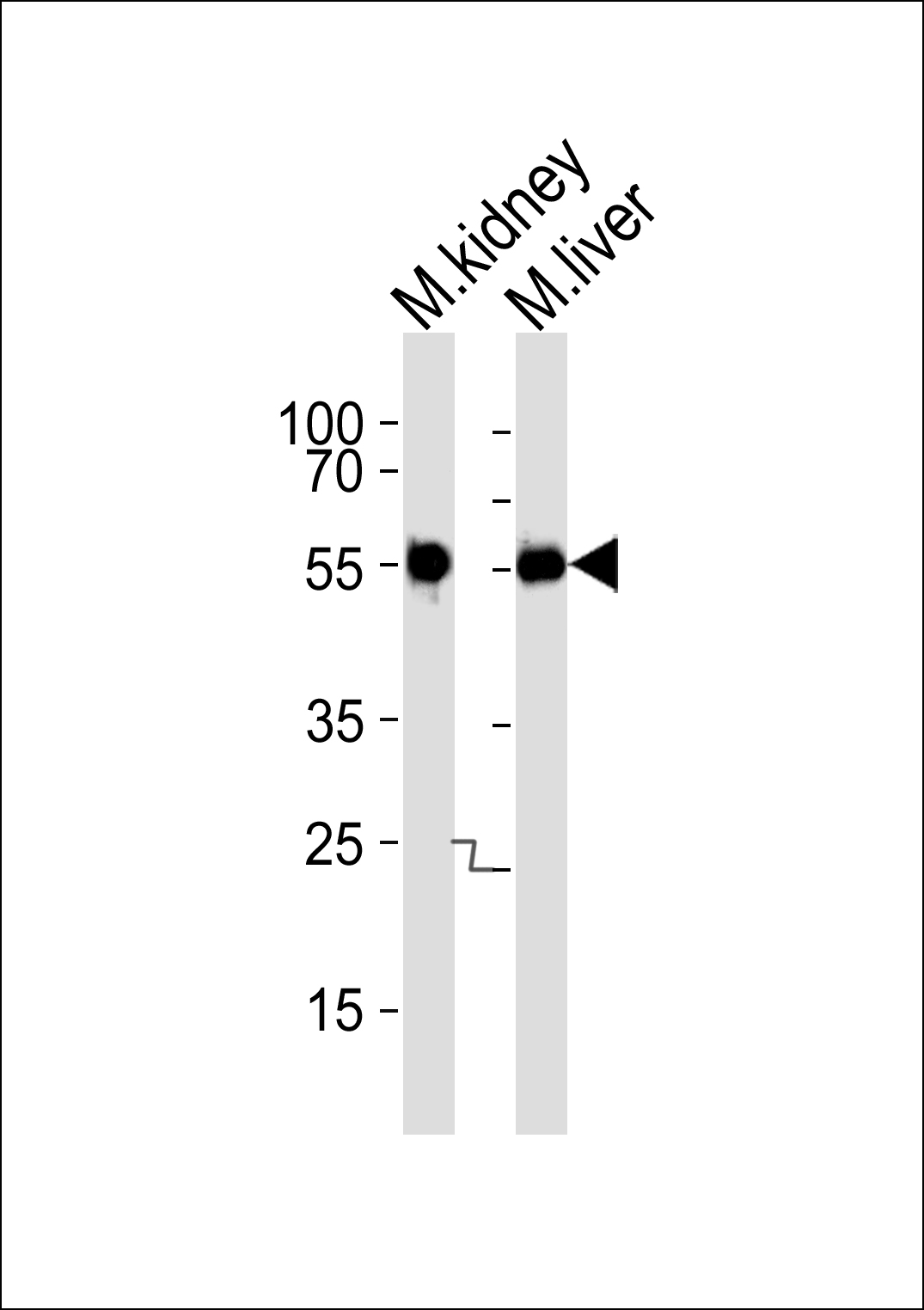 Rabbit Polyclonal Antibody to Mouse Csnk1g3