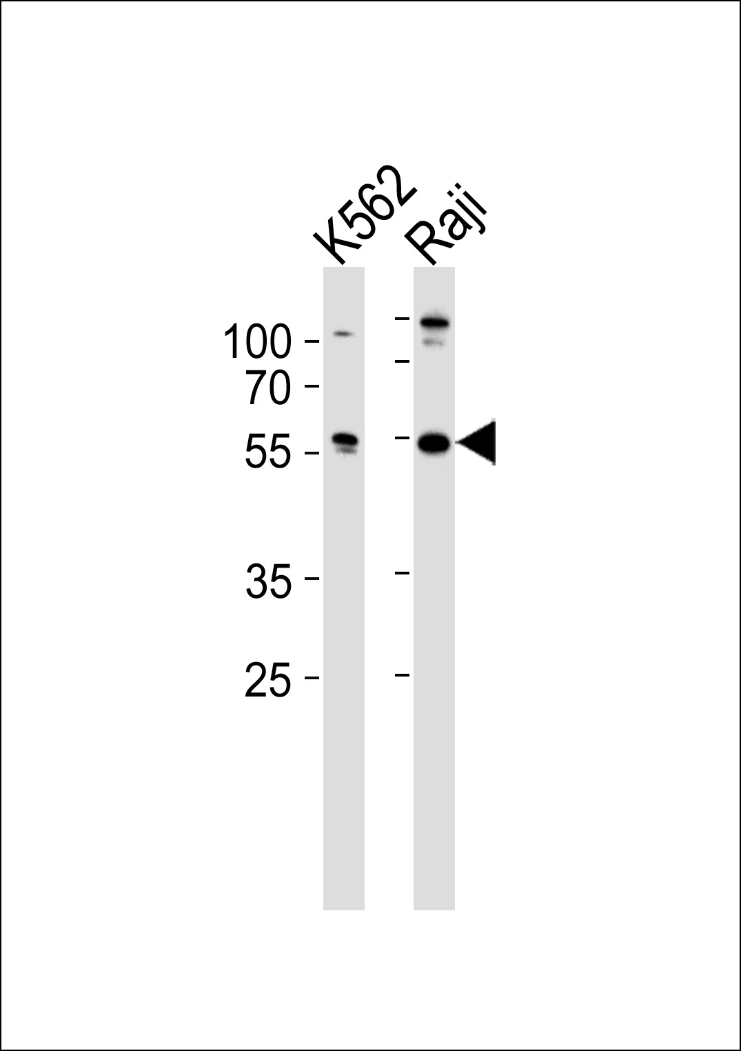 Rabbit Polyclonal Antibody to HCLS1