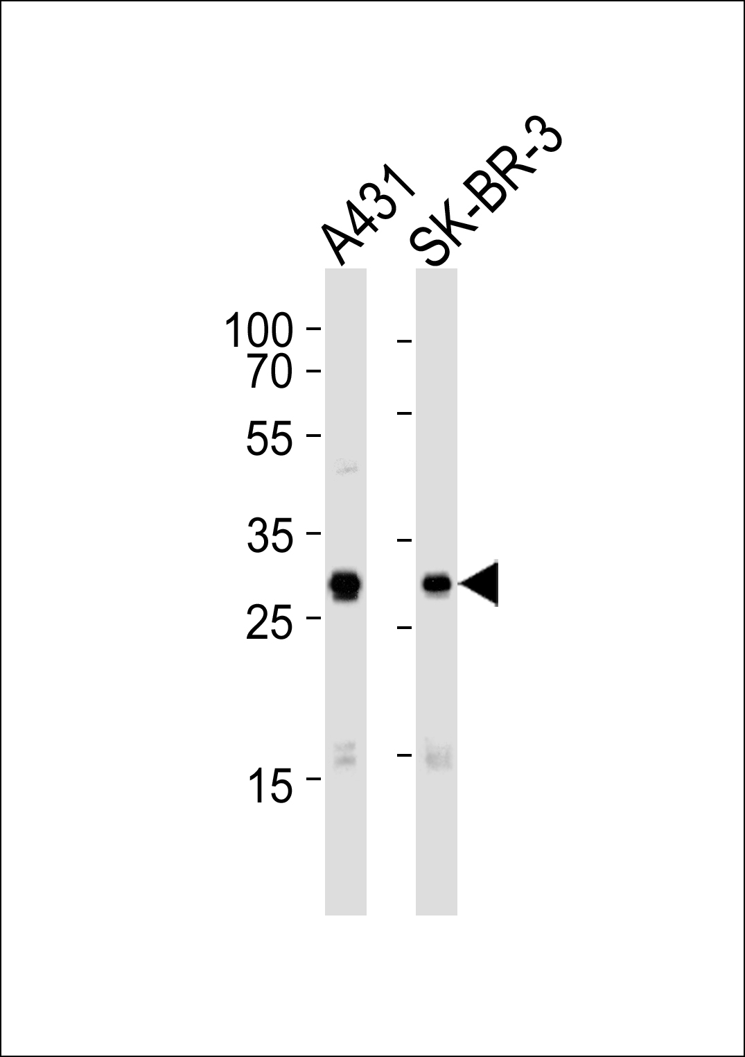 Rabbit Polyclonal Antibody to Mouse Cdk1