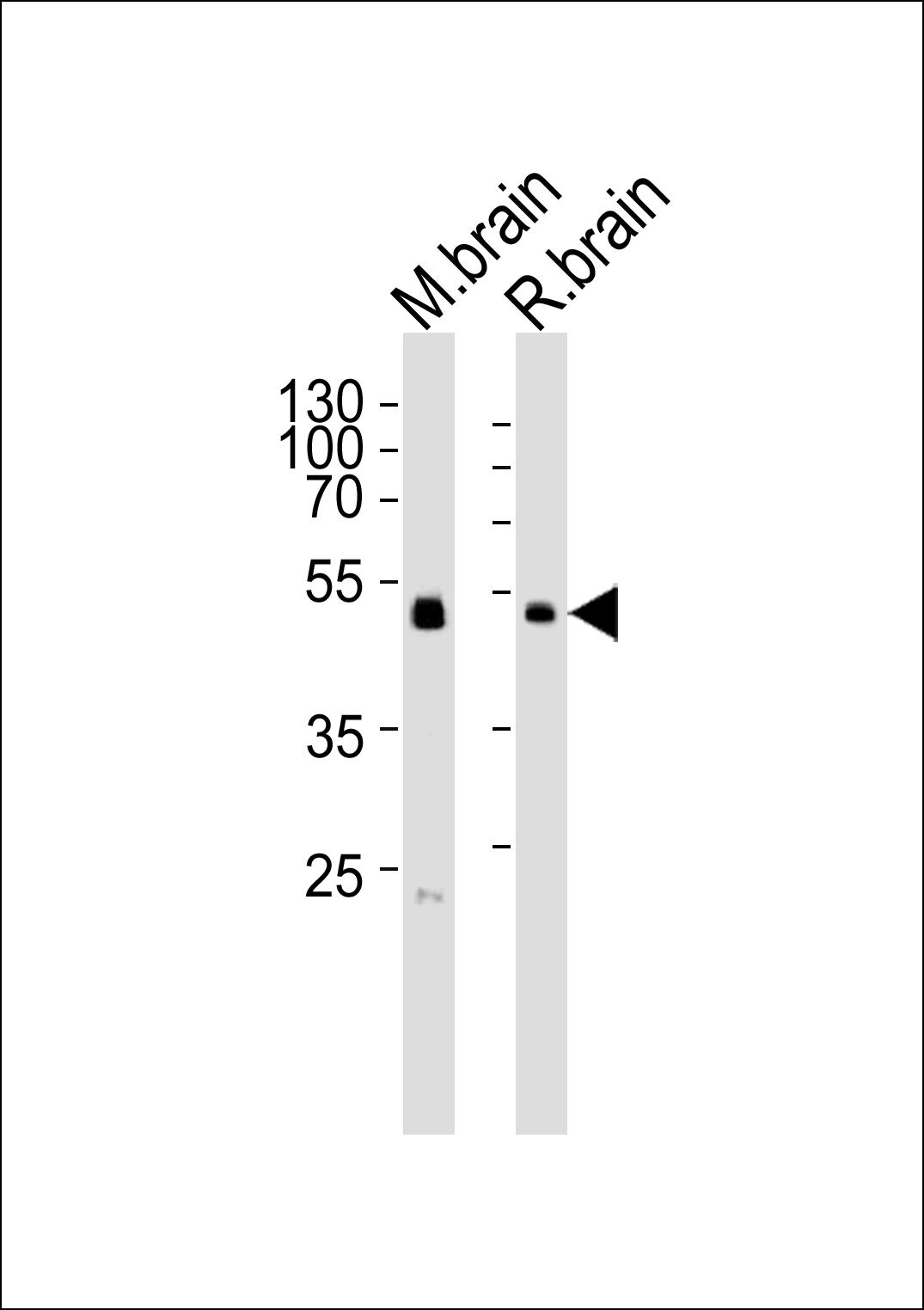 Rabbit Polyclonal Antibody to PIP4K2C (N-term)
