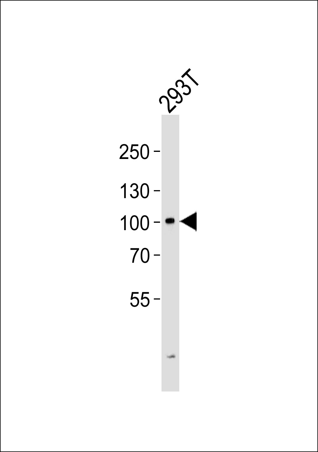 Rabbit Polyclonal Antibody to GIT2
