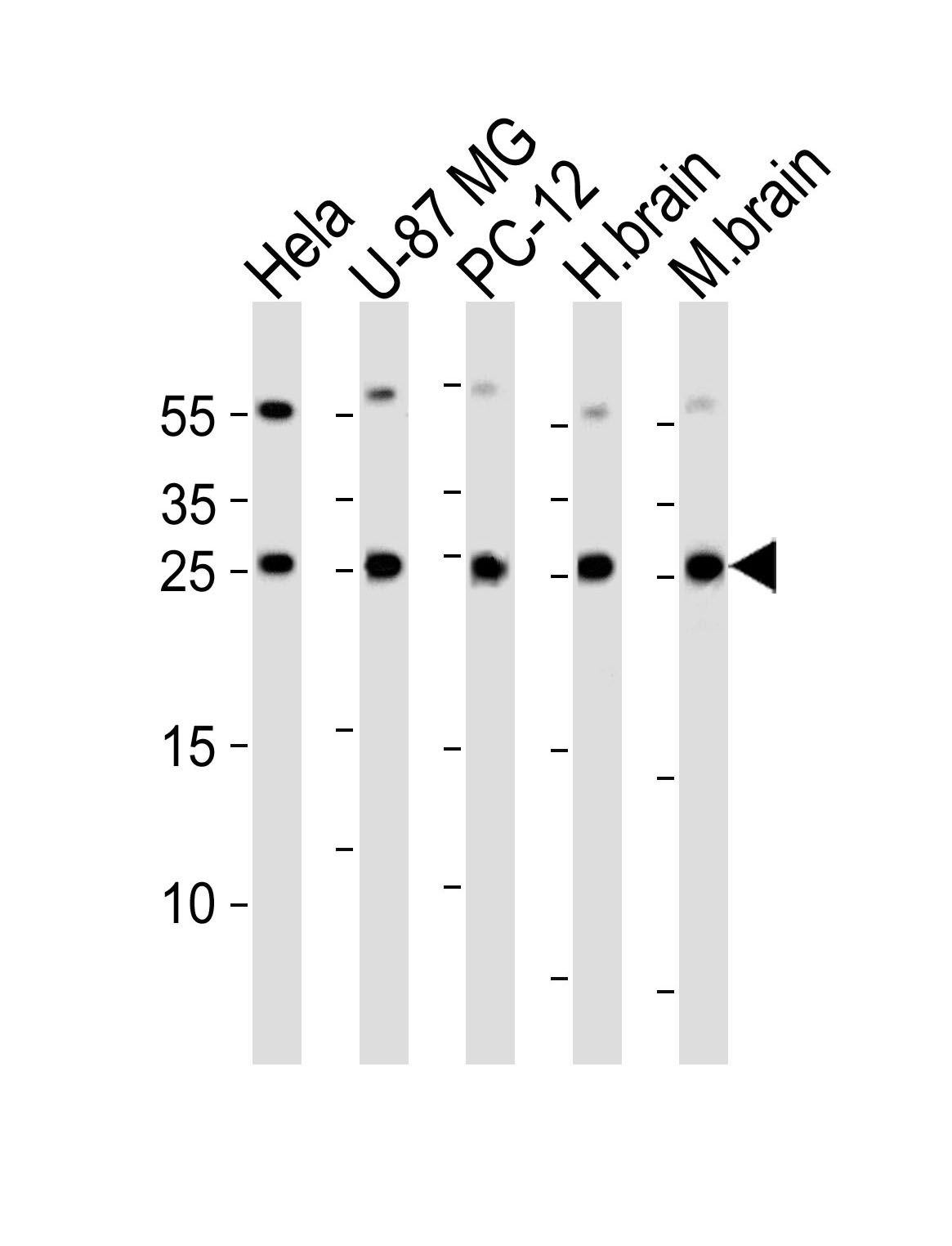 Rabbit Polyclonal Antibody to RAB35