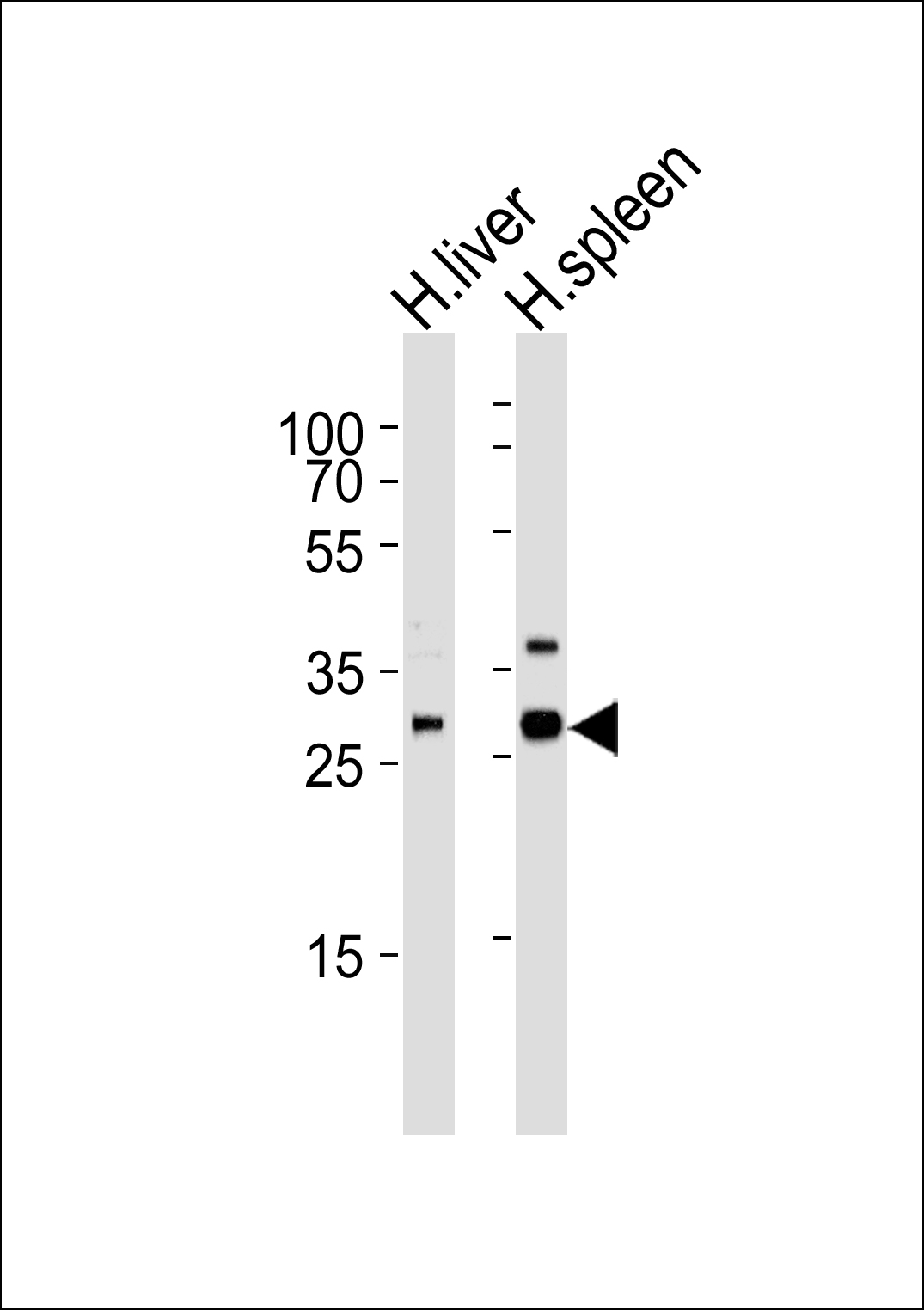 Rabbit Polyclonal Antibody to XAF1