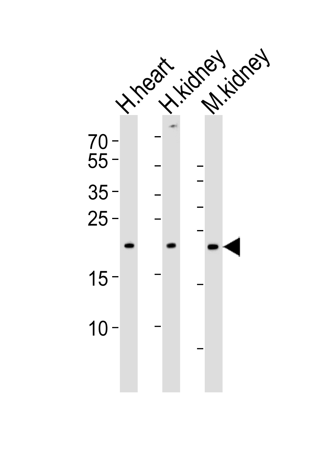 Rabbit Polyclonal Antibody to CYS1  (C-term)