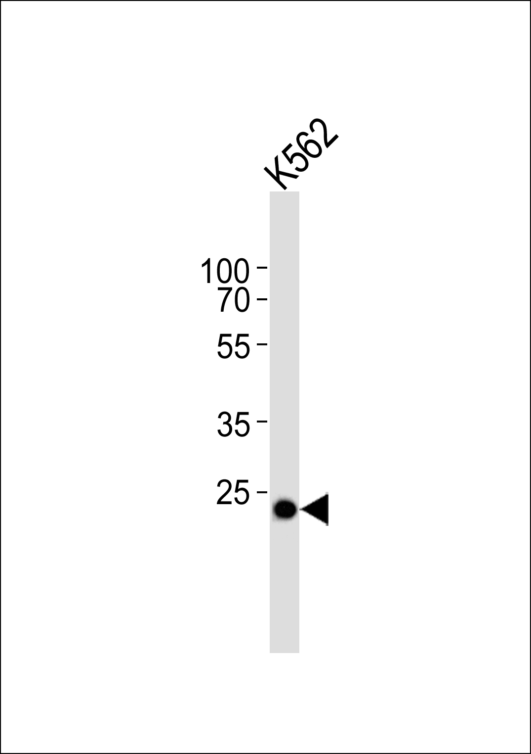 Rabbit Polyclonal Antibody to C21orf33