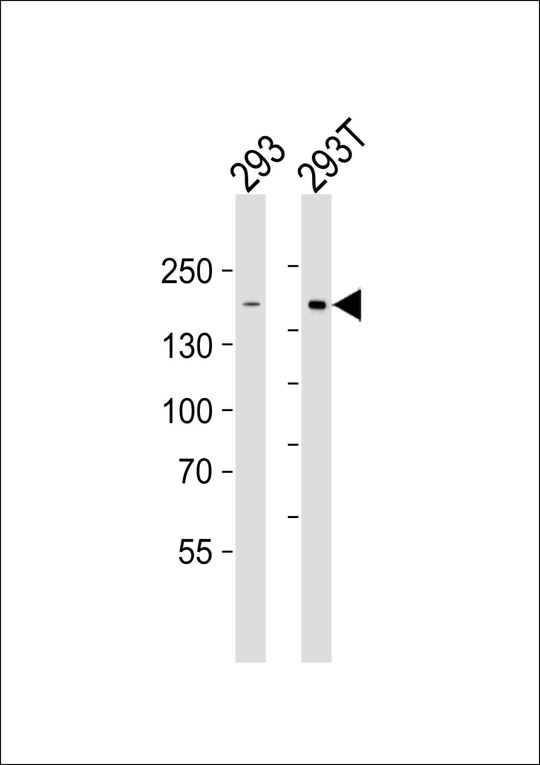 Rabbit Polyclonal Antibody to DIAPH1 (N-term)