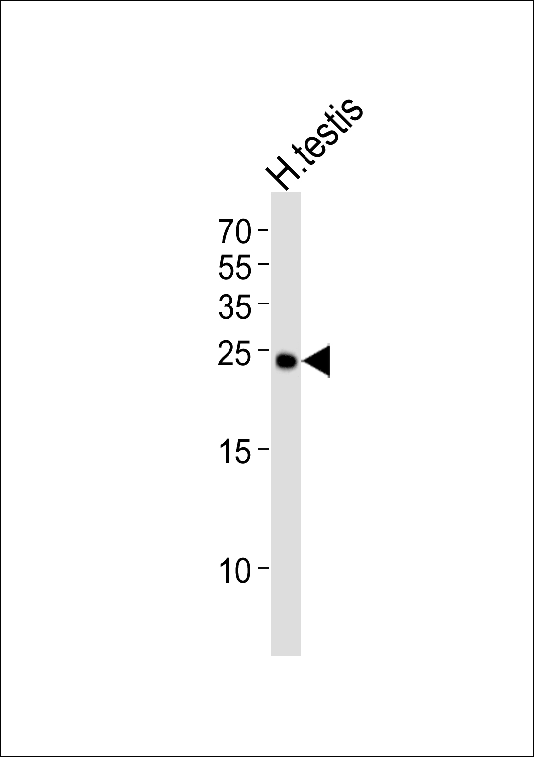 Rabbit Polyclonal Antibody to IZUMO2