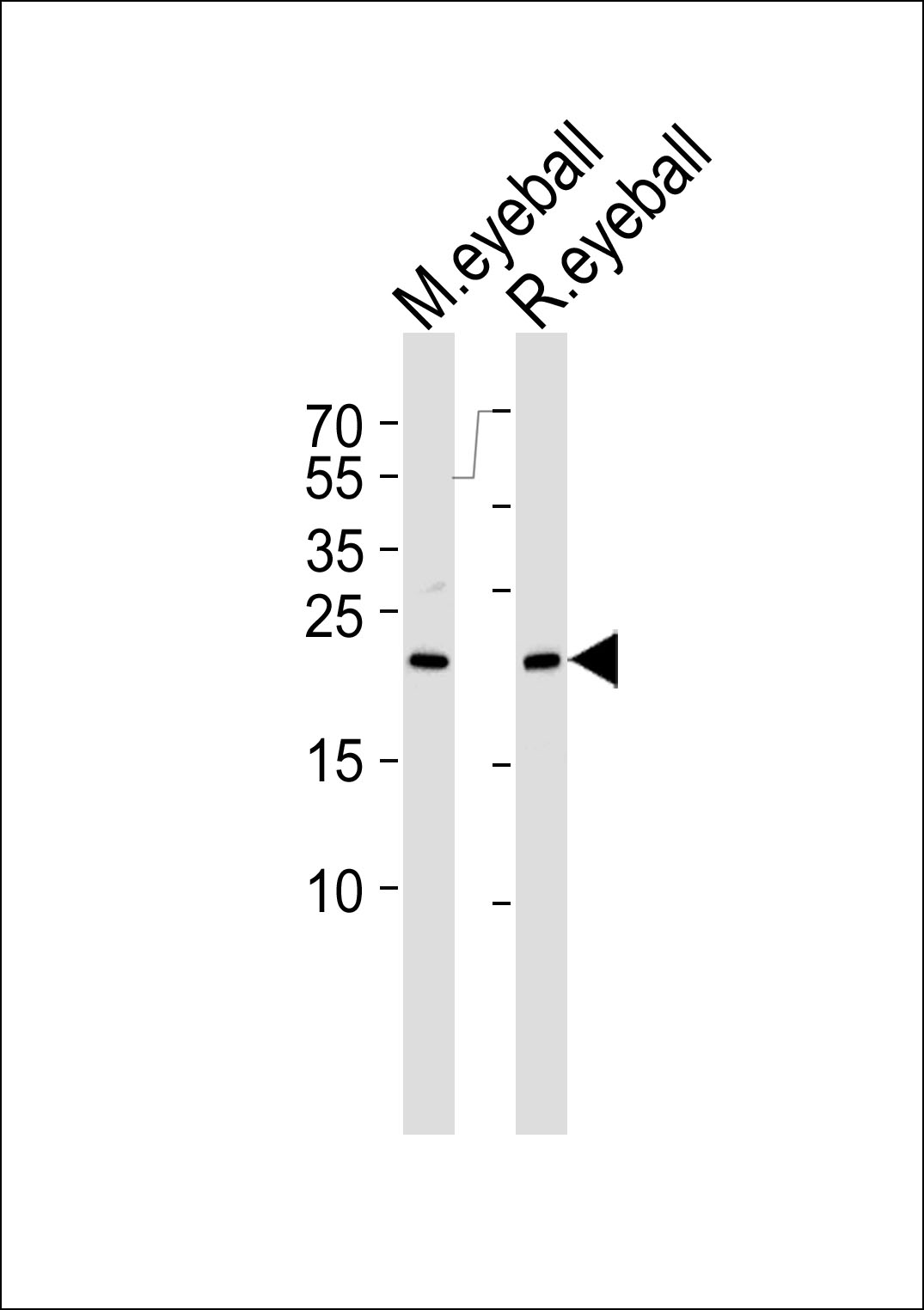 Rabbit Polyclonal Antibody to RCVRN