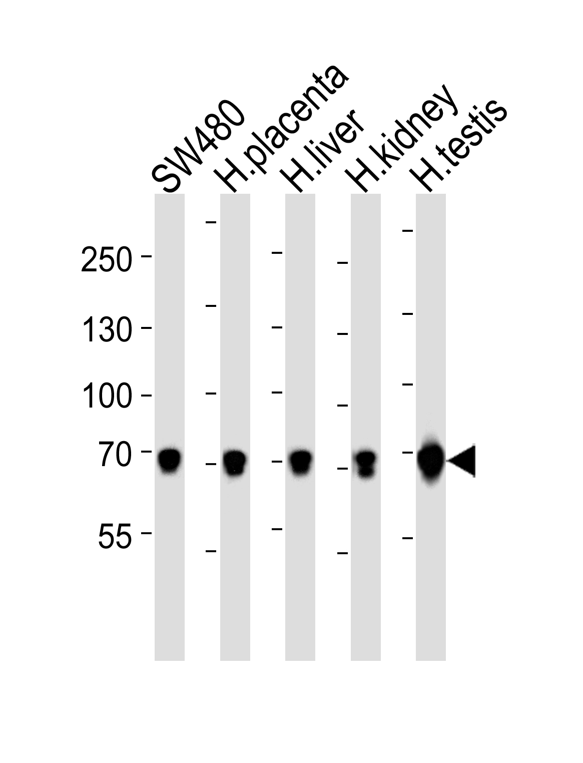 Rabbit Polyclonal Antibody to TRPV6