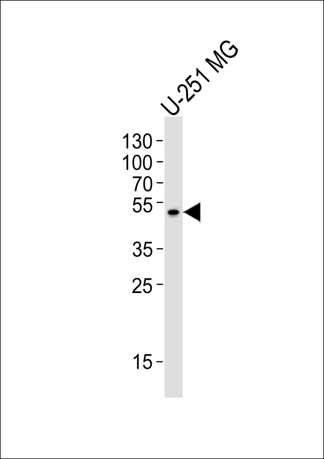 Rabbit Polyclonal Antibody to ZNF830
