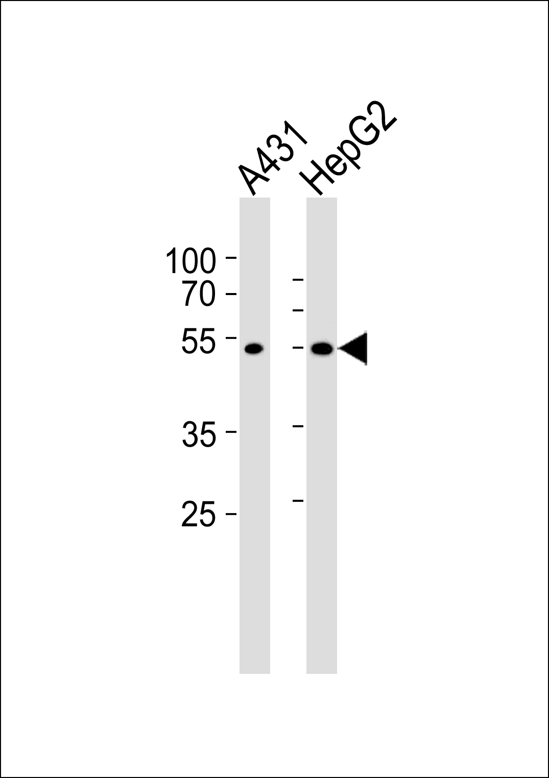 Rabbit Polyclonal Antibody to SAMM50