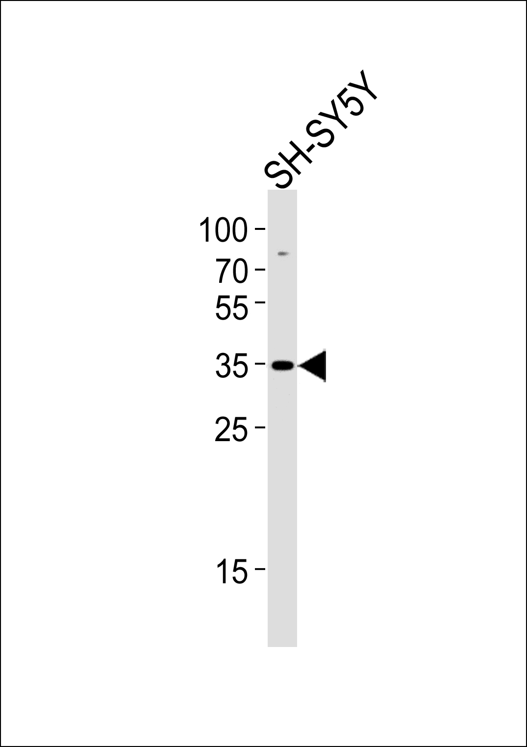 Rabbit Polyclonal Antibody to STX1B
