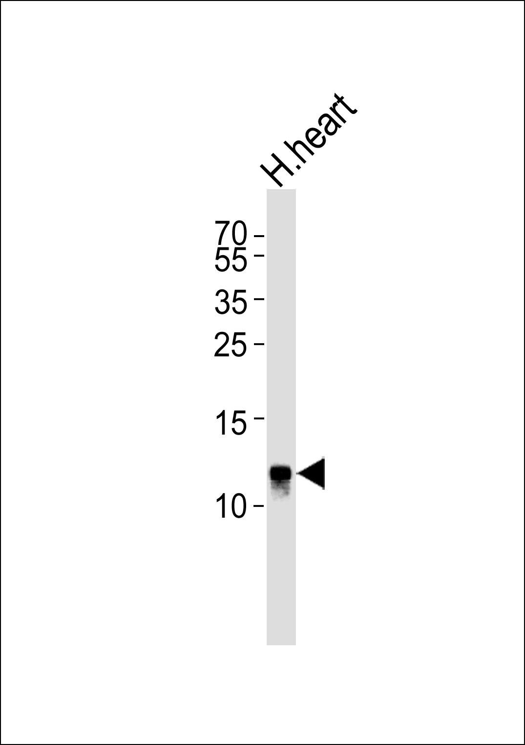 Rabbit Polyclonal Antibody to NDUFV3