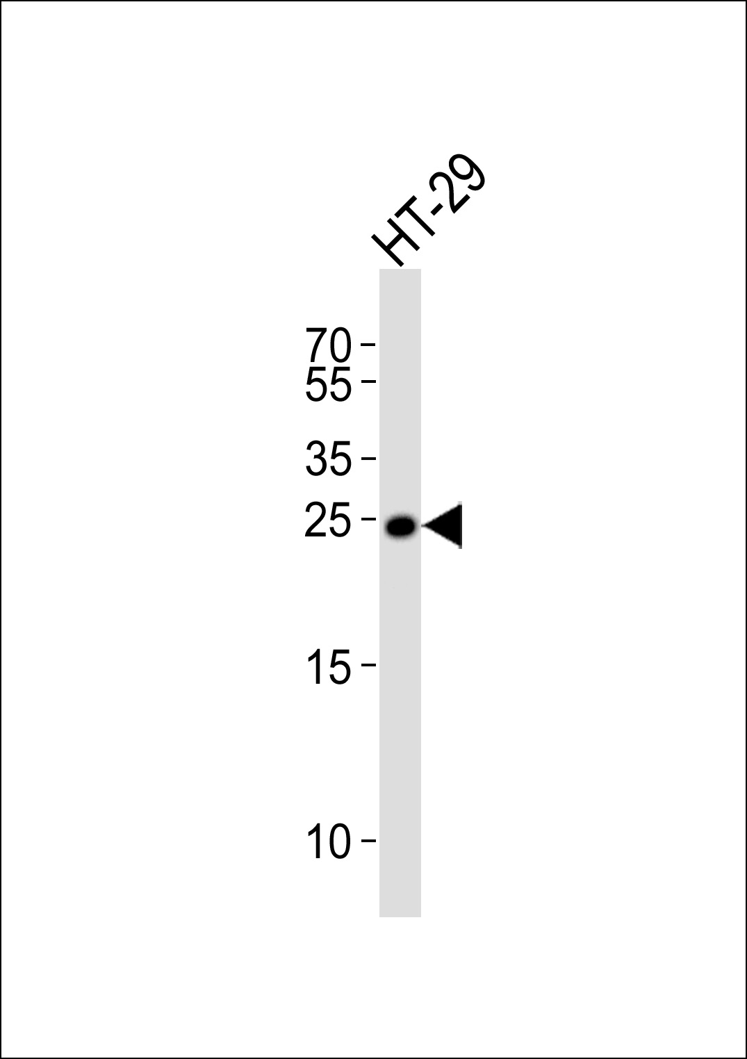 Rabbit Polyclonal Antibody to MAD2L1
