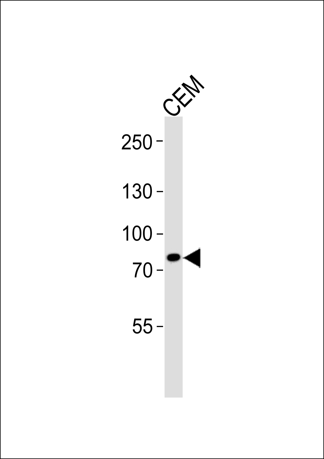 Rabbit Polyclonal Antibody to ACAP3