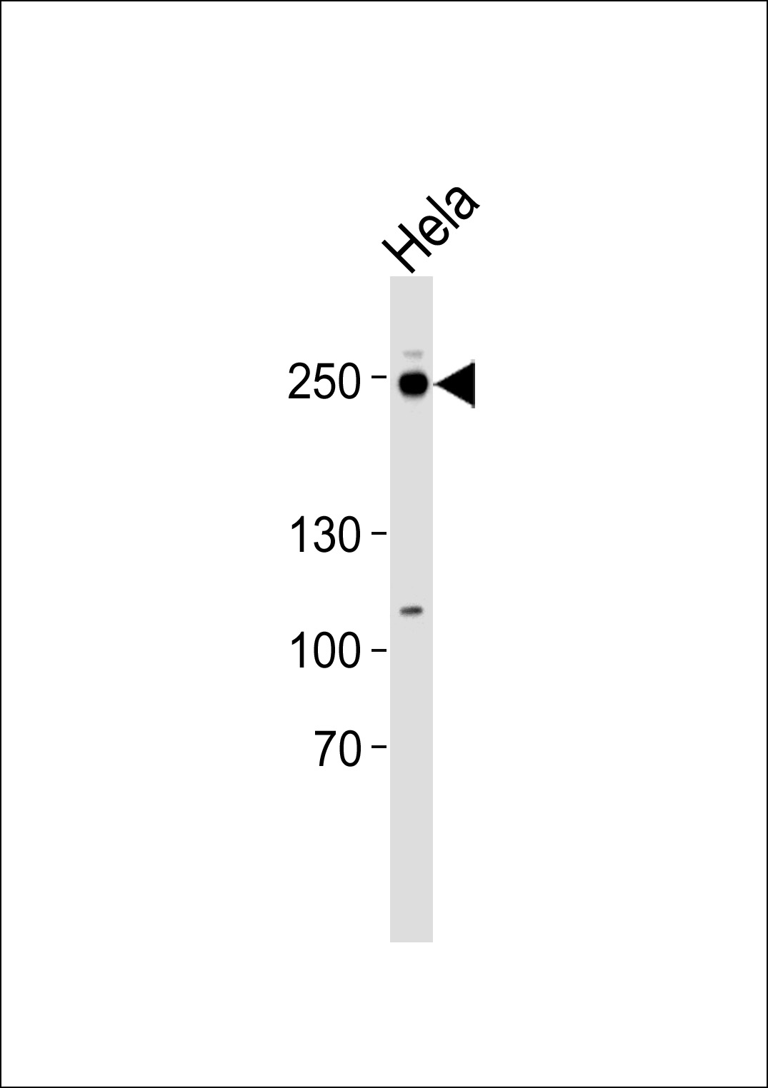 Rabbit Polyclonal Antibody to RSF1