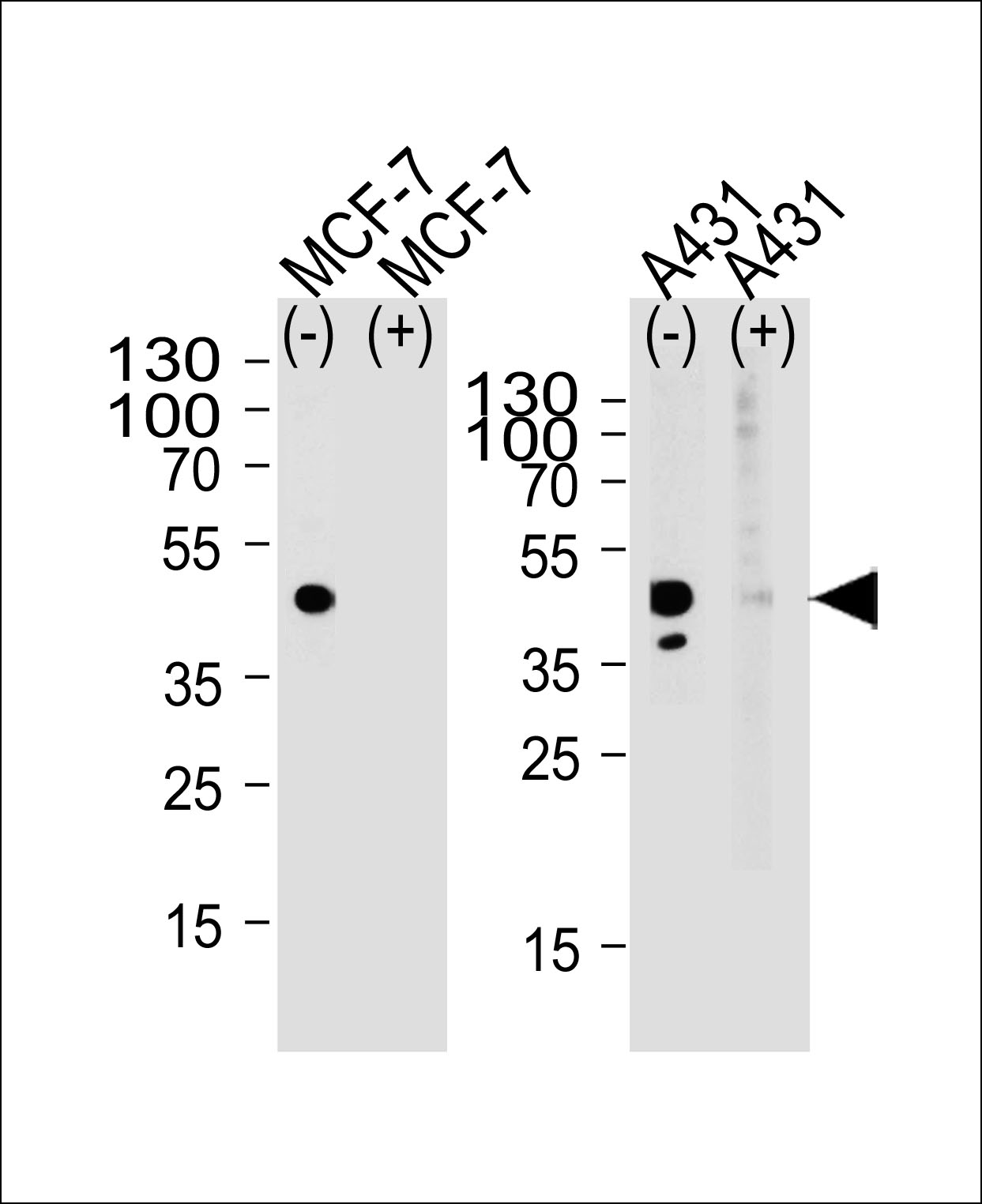 Rabbit Polyclonal Antibody to CALCR