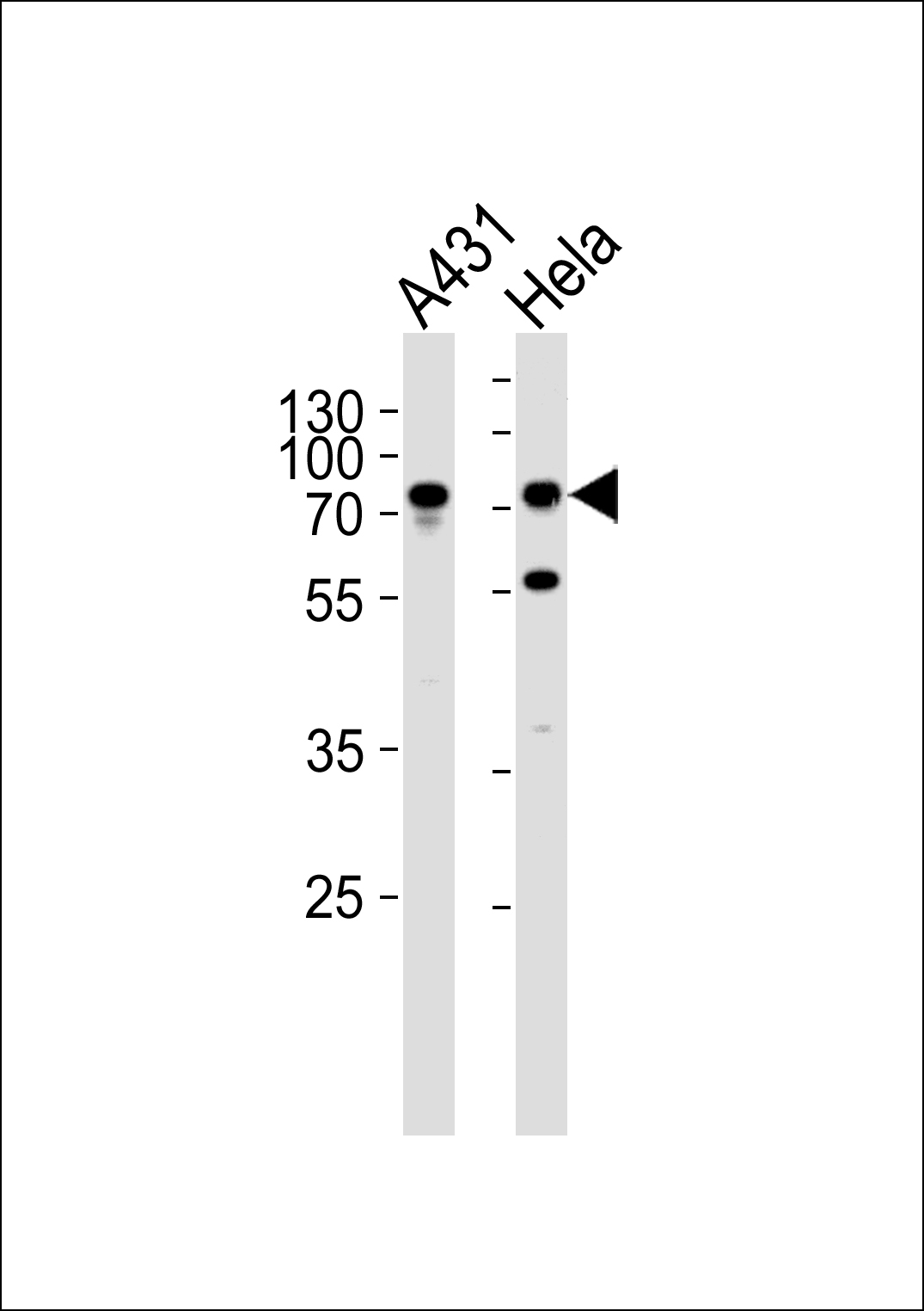 Rabbit Polyclonal Antibody to SEPT9